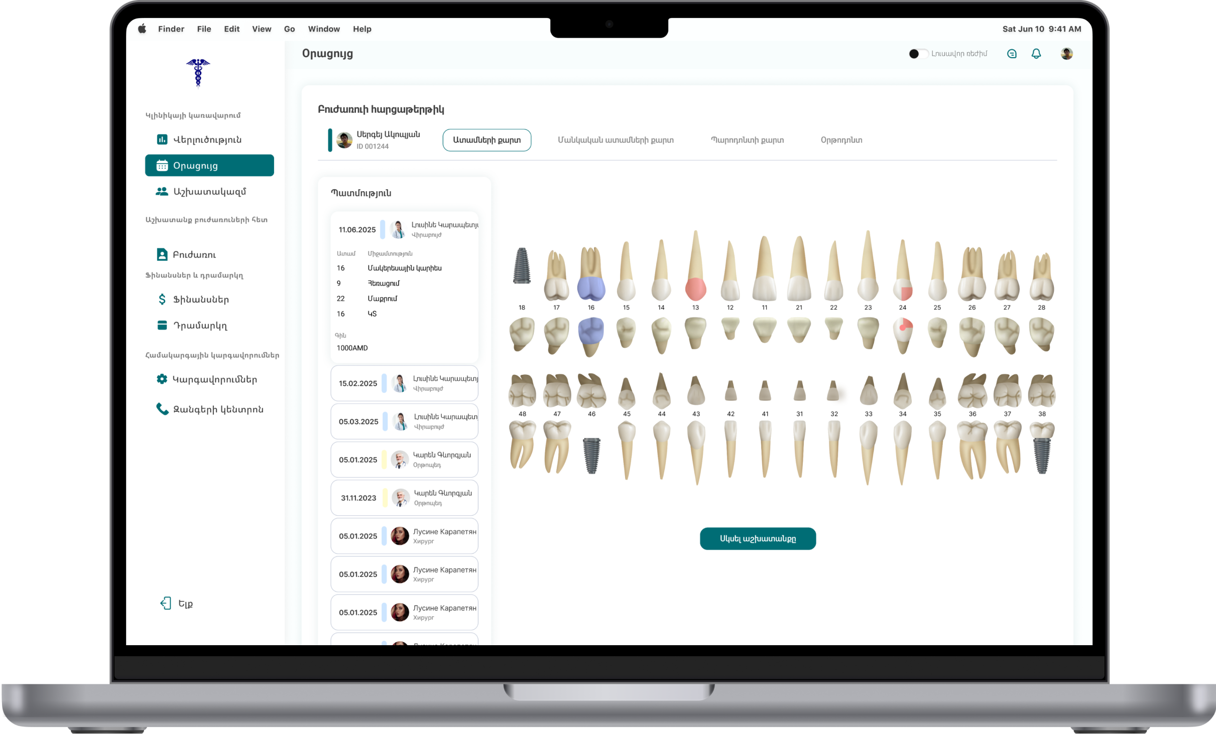 teeth map mock image